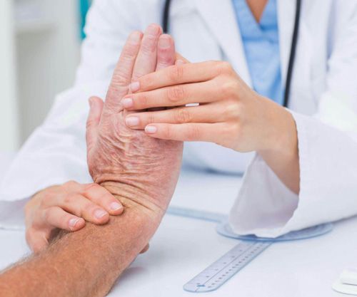 fisioterapeuta reumatológico aplicando masaje en manos a anciano