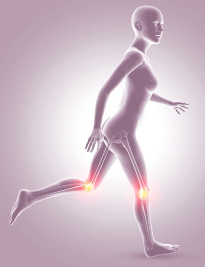 artrosis en ambas rodillas mujer
