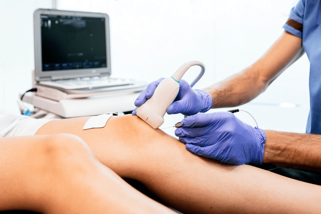 fisioterapeuta en alicante realizando una ecografía musculoesquelética en la rodilla de un paciente